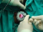 DGHAL (Met. Morinagi) - HEMOROIDY ( - Medica Trend  Gabinet Chirurgiczny - Sławomir Kaczmarek Kalisz