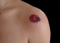 tatuaze Tatuaże - Jabłonka charismatattoo