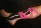 kinesio taping - Gabinet Masażu Łódź