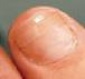 pedicure medyczny w domu Szczecin - Anbru-Art. Mobilny pedicure medyczny Szczecin
