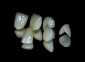 Protetyka - Dental Art Ilona Wolniewicz Gdynia