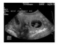 Monitoring ciąży Usługi weterynaryjne - Lipsko Centrum Zdrowia Zwierząt Lekarz Weterynarii