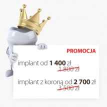 Tanie implanty-promocja! - Nova Estetica Klinika Dentystyczna Warszawa