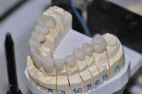 Implanty Ortodoncja Mikroskop - Dental Esthetic - Centrum stomatologii - M. Sokół Kraków