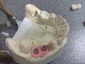 Implanty Ortodoncja Mikroskop Kraków - Dental Esthetic - Centrum stomatologii - M. Sokół