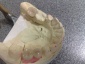 Implanty Ortodoncja Mikroskop Botox - Kraków Dental Esthetic - Centrum stomatologii - M. Sokół
