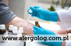 Testy alergiczne skórne i płatkowe - Gabinet Alergologiczny dr Maria Jarlińska Wrocław