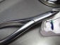 Wykonywanie aparatów ortodontycznych Wiślinka - OrtAn Lab Laboratorium Ortodontyczne Anna Kuffel