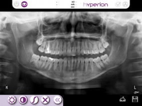 Pantomogram - Jesionowa Dental Clinic Klinika Stomatologiczna Michałowice