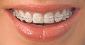 Ortodoncja - Jesionowa Dental Clinic Klinika Stomatologiczna Michałowice