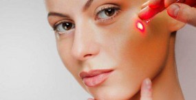 Laserowe usuwanie naczynek - Estetix Kosmetologia Estetyczna i Laserowa Zgierz