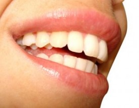 Wybielanie zębów - Stomadent - Prywatne Centrum Stomatologii NZOZ Słubice