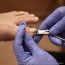 Korekcja wrastających paznokci za pomocą klamry metalowej Sanok - Gabinet Rehabilitacyjno Podologiczny w Sanoku