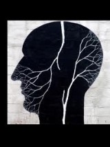 cukrzyca niedokrwienia - Olszewski Jacek, dr nauk med. Spec. chirurgii naczyniowej Gdynia