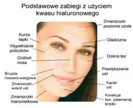 mezoterapia igłowa MSP - Akademia MSP Ochrony Zdrowia i Urody Gorzów Wielkopolski
