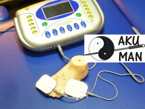 Elektrostymulacja przezskórna TENS - Akupunktura i terapia manualna AKU MAN Warszawa