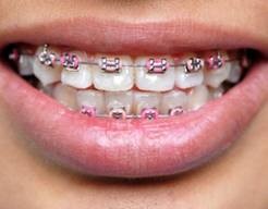 Ortodoncja Tychy Mikołów Lędziny Katowice - DentalCare Klinika Pięknego Uśmiechu Tychy