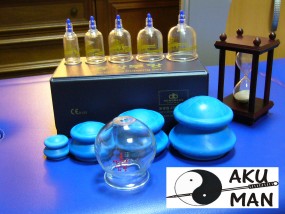 Masaż chińską bańką podciśnieniową, magnetopunktura. - Akupunktura i terapia manualna AKU MAN Warszawa