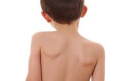 Ćwiczenia w wadach postawy - Gabinet Masażu ,,Nikozja   Żabia Wola