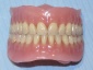 Protezy całkowite i częściowe - Gabinet Dentystyczny  Nowy Świat  Gliwice