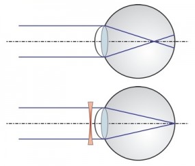 Oferujemy profesjonalne doradztwo z zakresu optyki okularowej - Zakład Optyczny OPTYK Skibiccy Wągrowiec
