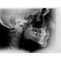 Zdjęcie cefalometryczne - NZOZ Stomatologia Bez Bólu Jelenia Góra