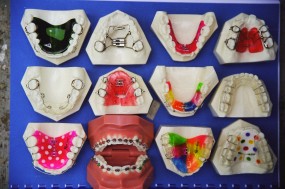 Wczesne leczenie ortodontyczne -  Dentystka  - Julita Torchalska - Gabinet Stomatologiczny Kozy