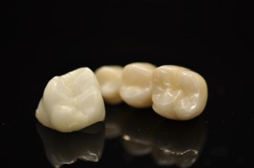 Korony cyrkonowe Rybnik, Gliwice, Zabrze, Katowice, Bytom - Centrum Frezowania cyrkonu i CrCo Yellow-Med Rybnik