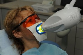 Wybielanie zębów światłem ultrafioletowym. - VIP DENTAL Prywatna Klinika Implantologii i Stomatologii Estetycznej Bielsko-Biała