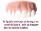 Implant stomatologiczny Praktyka Stomatologii Estetycznej lek dent Mirosław Szymonek