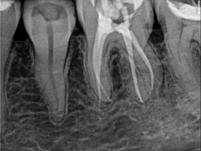 Dentysta Gliwice - Gabinet Dentystyczny  Nowy Świat  Gliwice