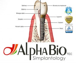 Implanty zębowe - Centrum Stomatologii MADEJDENT lek.dent. Aneta Madej Łambinowice