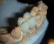 korony zębowe gabinet stomatologiczny - Grójec Kardent Gabinet Stomatologiczny i Laboratorium Protetyki Dentystycznej