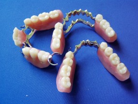 protezy zębowe - Kardent Gabinet Stomatologiczny i Laboratorium Protetyki Dentystycznej Grójec