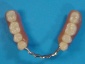 protezy szkieletowe Grójec - Kardent Gabinet Stomatologiczny i Laboratorium Protetyki Dentystycznej