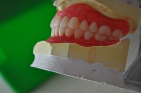 protezy akrylowe - Kardent Gabinet Stomatologiczny i Laboratorium Protetyki Dentystycznej Grójec