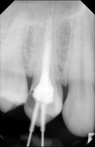 Leczenie zębów  zachowawcze Lekarze stomatolodzy - Kraśnik DOKTOR Niepubliczny Zakład Opieki Zdrowotnej, Centrum Stomatologiczno-Medyczne, Przychodnia