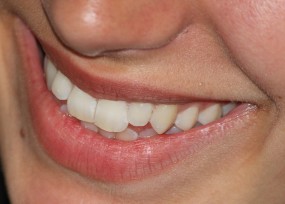 Leczenie kanałowe zębów - Gabinet Stomatologiczny Małgorzata Jeziorowska Wręczyca Wielka