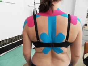 Kinesiotaping - Gabinet Neurologiczny Alicja Zgrzebnicka Jaworzno