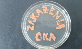 wymaz z oka w kierunku Chlamydia trachomatis - MICROFAM Laboratorium Mikrobiologiczne, badania mikrobiologiczne Wrocław