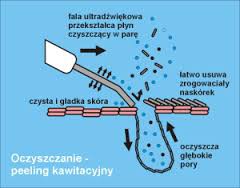 Peeling kawitacyjny - ultradźwięki - Beauty Lady - Gabinet Kosmetyki Nowoczesnej Edyta Trzcińska Lublin