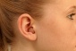 aparat słuchowy wewnątrzuszny Kozy - AURIS-MEDIC Aparaty Słuchowe