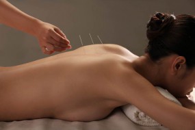 Akupunktura zdrowie - AcuMedic Olsztyn