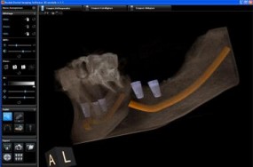 CBCT 3D - Diagdent - Pracownia Radiologi Stomatologicznej na Ursynowie Warszawa
