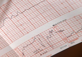EKG wysiłkowe serca - Indywidualna Praktyka Lekarska Dariusz Lesiński Rumia