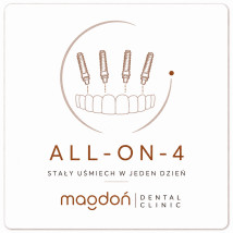 All-on-4 - Magdoń Dental Clinic Pruszcz Gdański