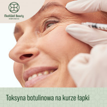 Botoks lwia zmarszczka - MediWell Beauty, dr Marta Skoczylas Warszawa