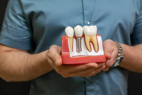 Leczenie stomatologiczne - Dental Family Grójec