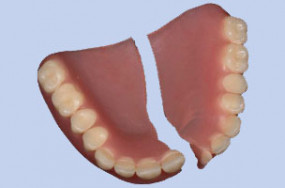 Ekspresowa naprawa protez - Pracownia Techniki Dentystycznej Kolno