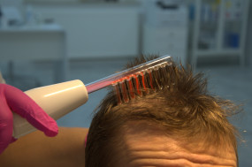 Darsonvalizacja - Trychomed Gabinet Trychologiczny Rozalia Bugara Pilawa